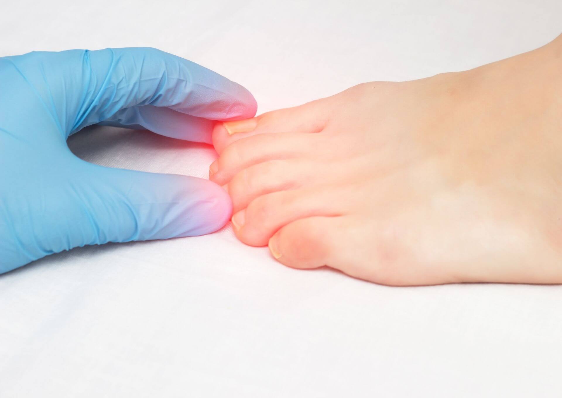 Zabieg regeneracji paznokci