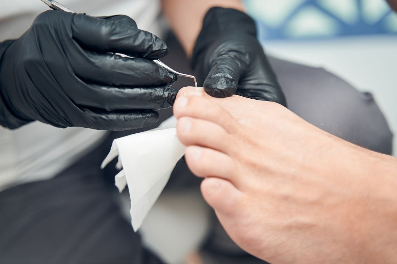 podologia-imielin podologia Imielin